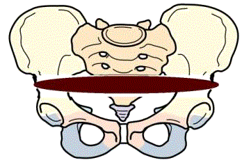 骨盤ゴムチューブ運動